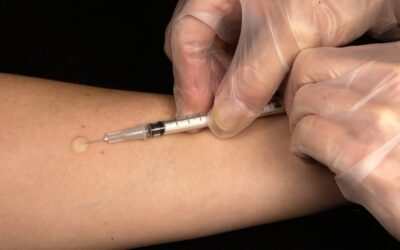 MATRIX. Epidemia powikłań poszczepiennych, odra