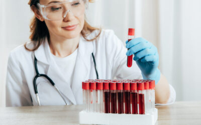 Anemia – przyczyny, objawy i diagnostyka