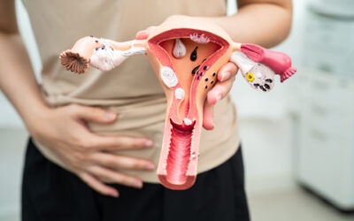 Endometrioza: naturalne metody łagodzenia bólu, stanów zapalnych i zmęczenia