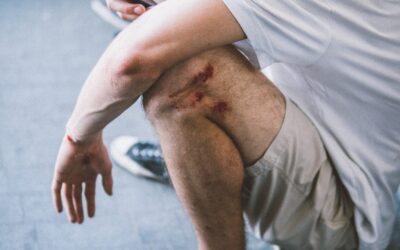 Naturalne sposoby na przyspieszenie gojenia ran