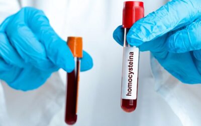 Homocysteina – mała cząsteczka, wielki problem