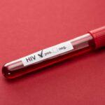 HIV wciąż jest wśród nas ale nie jest już wyrokiem śmierci