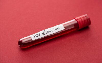 HIV wciąż jest wśród nas ale nie jest już wyrokiem śmierci